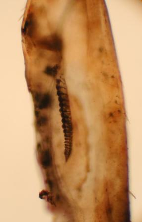 Poecilimon ampliatus - backfill of the Crista Acustica